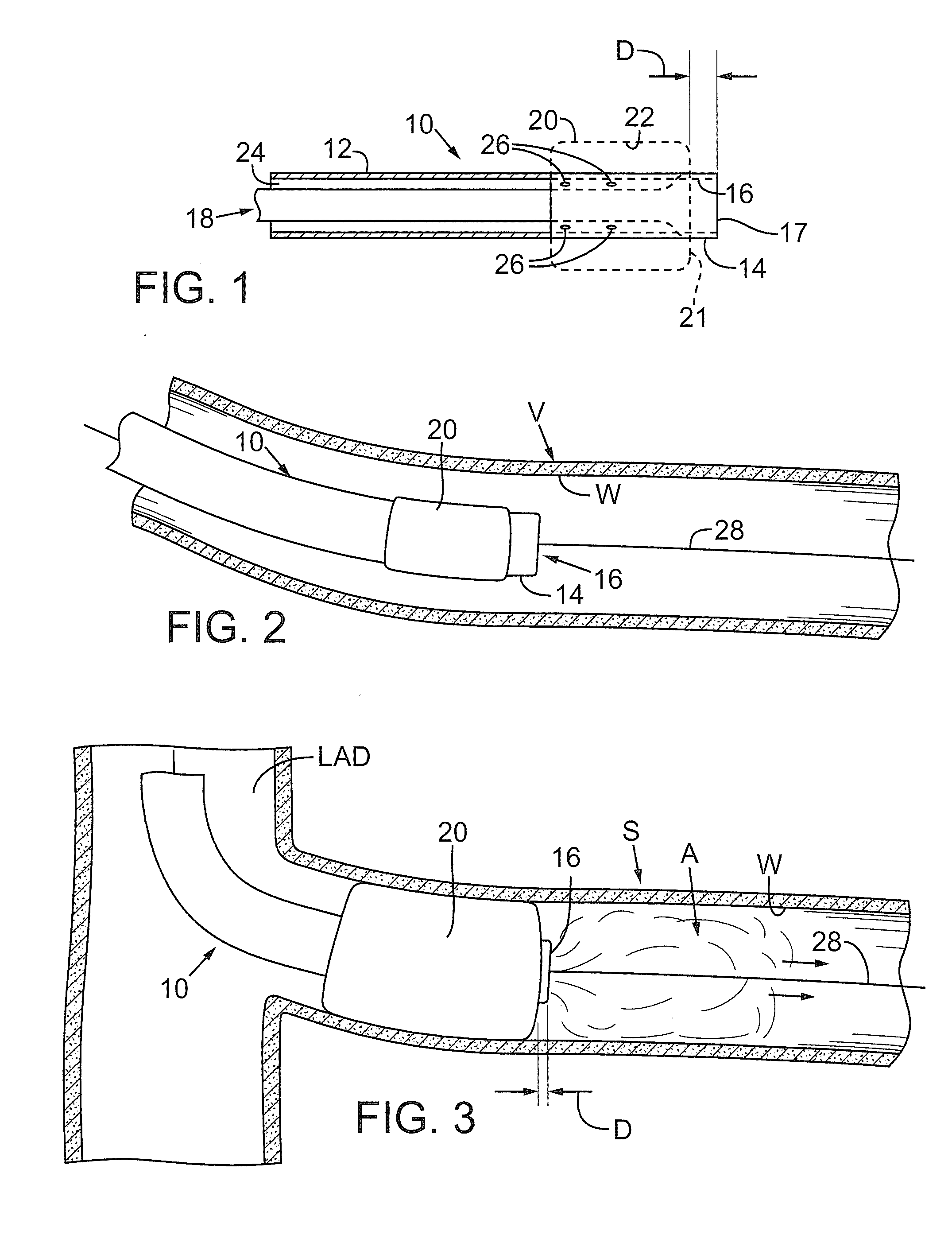 Devices and methods for treating chronic total occlusion