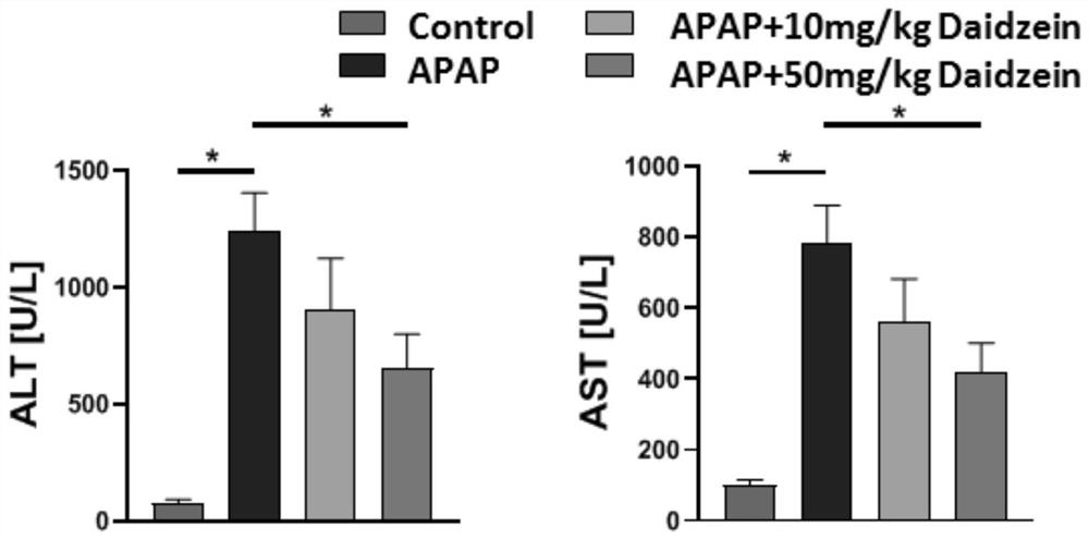 Application of daidzein in prevention and treatment of acetaminophen-induced acute liver injury