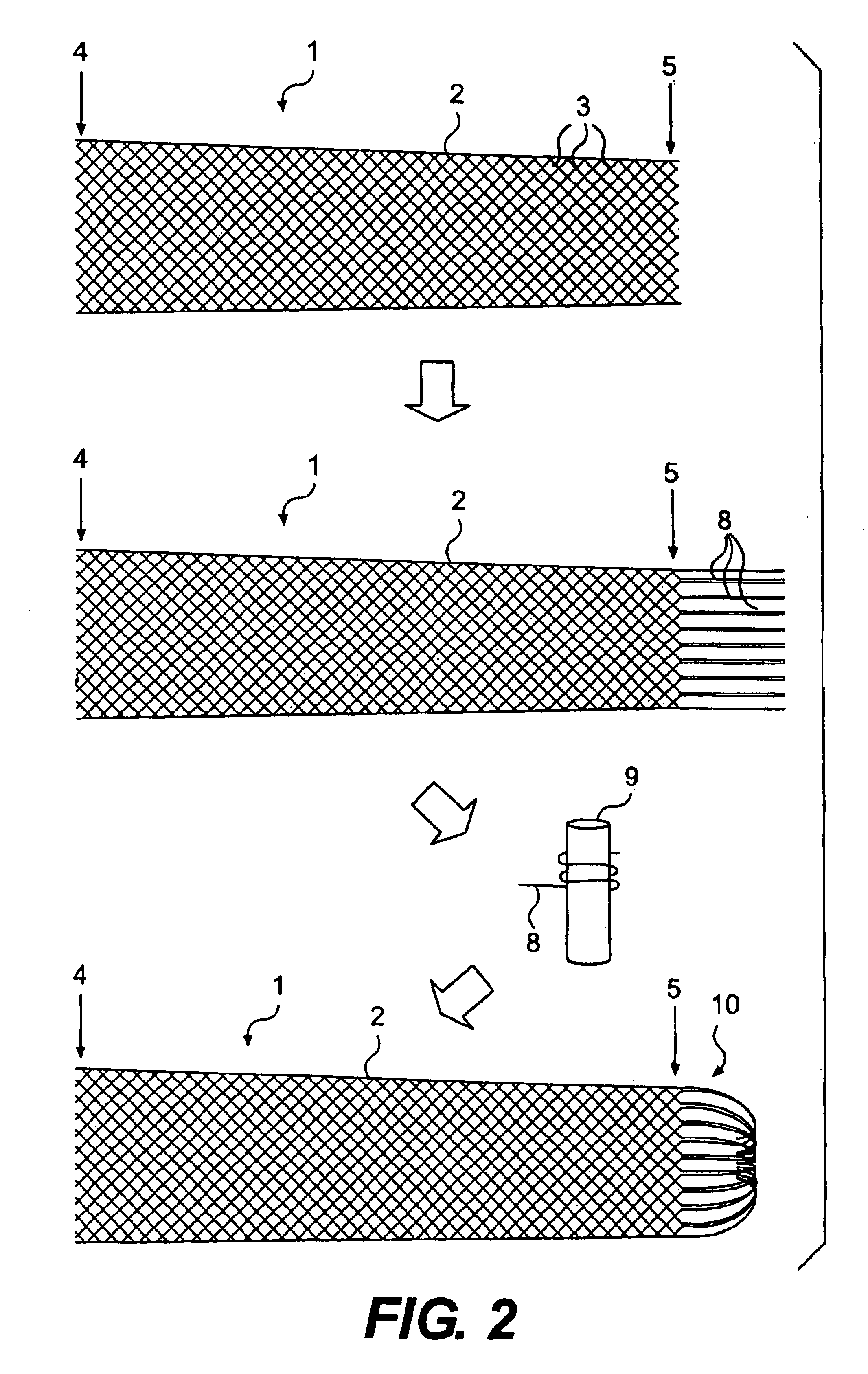 Medical stent with a valve and related methods of manufacturing