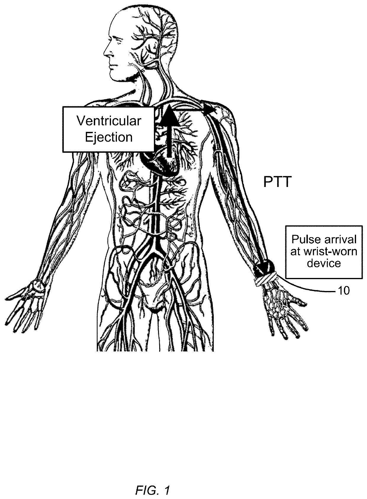 Blood pressure monitoring using a multi-function wrist-worn device