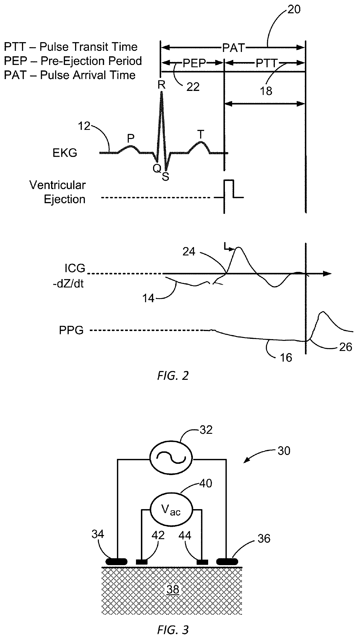 Blood pressure monitoring using a multi-function wrist-worn device