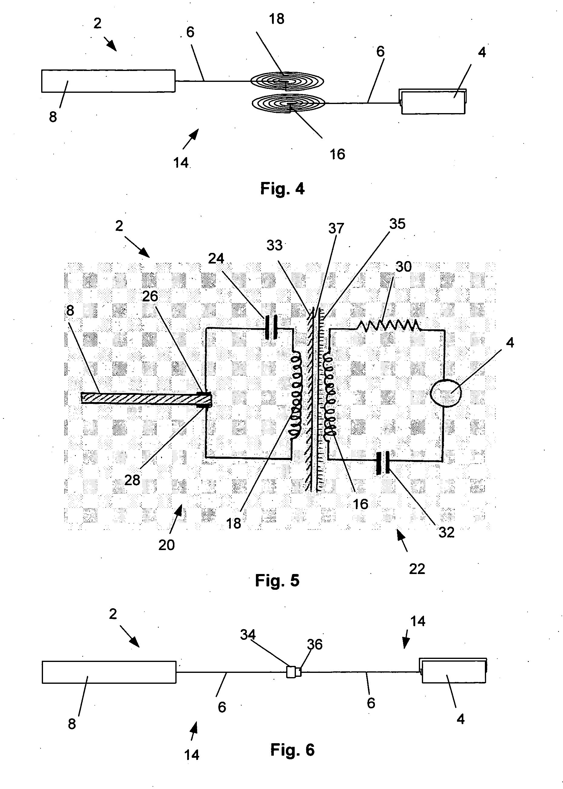 Airway implant and methods of making and using