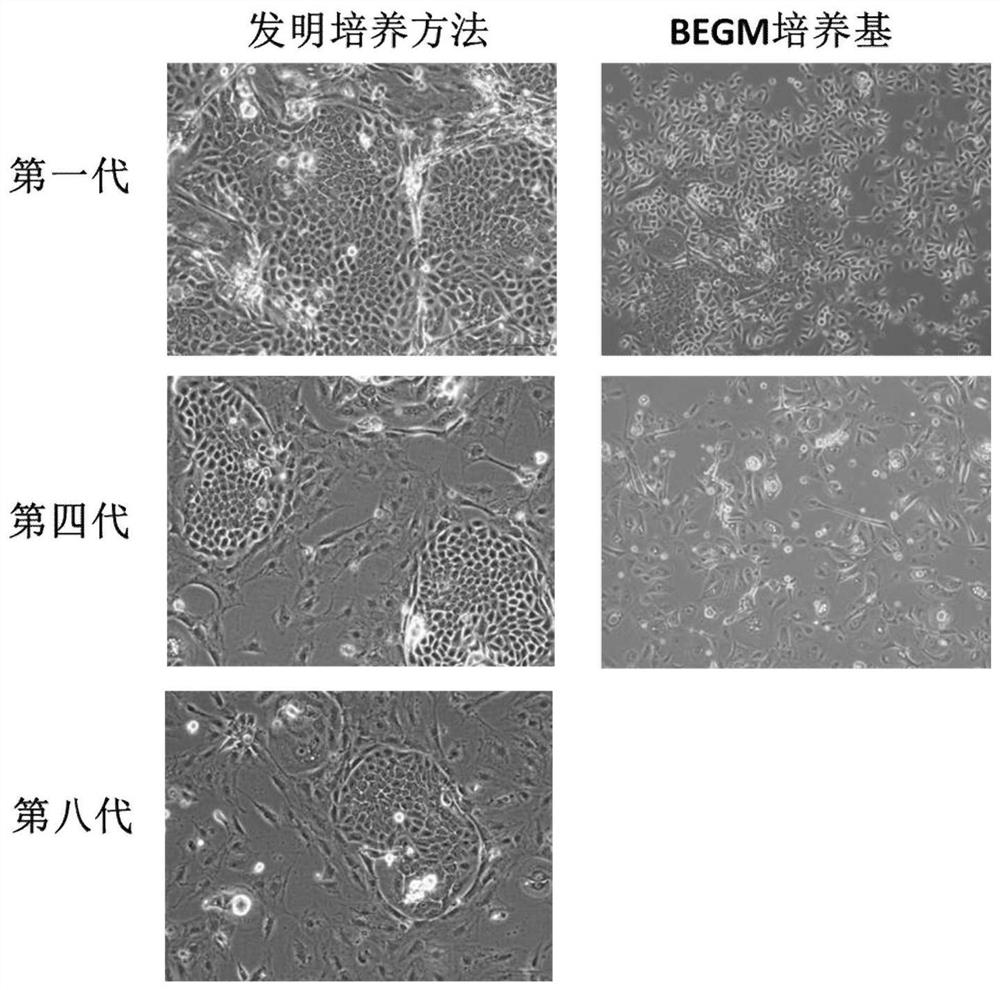 A kind of nasal epithelial stem cell culture method and nasal epithelial stem cell proliferation medium