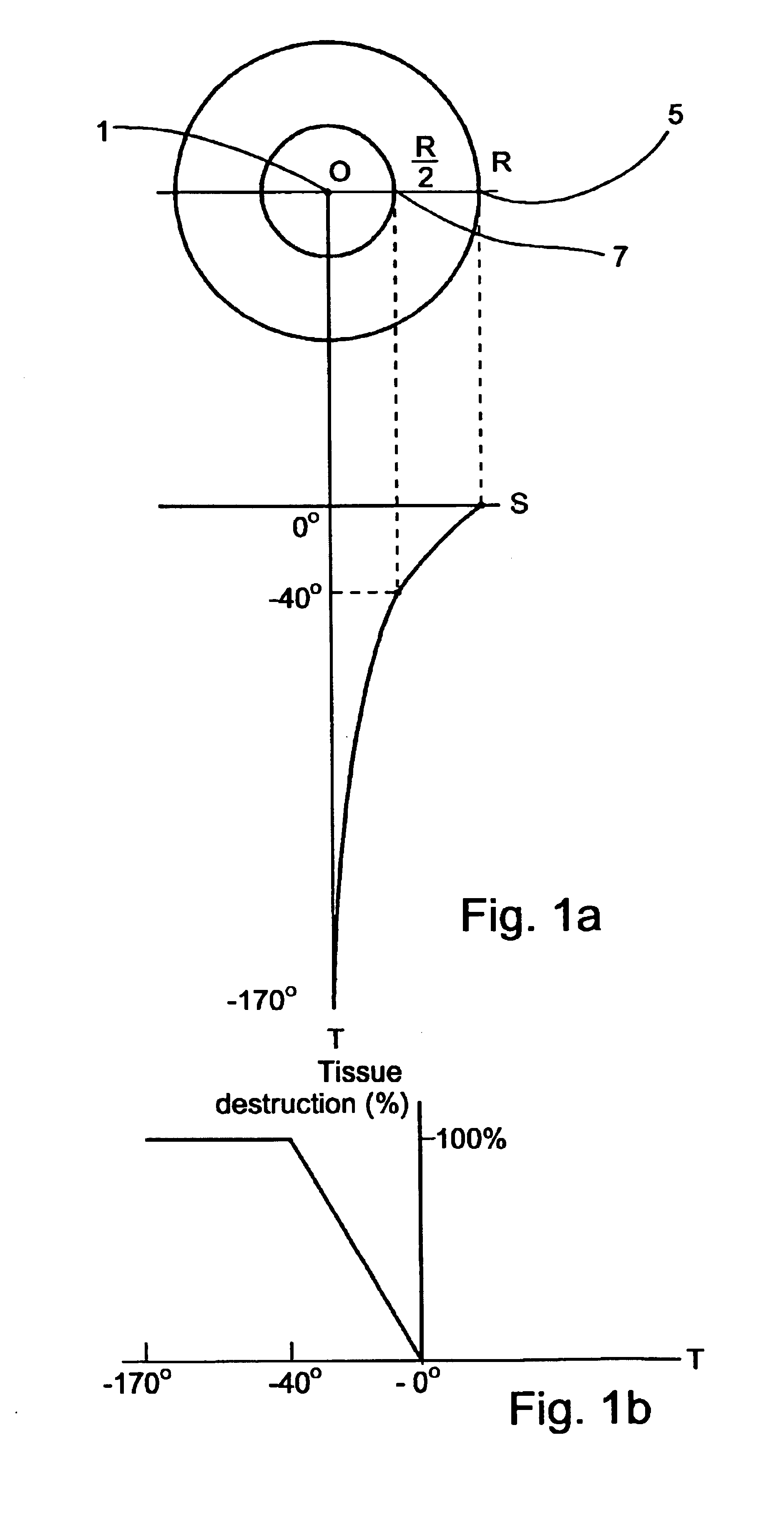 Planning and facilitation systems and methods for cryosurgery