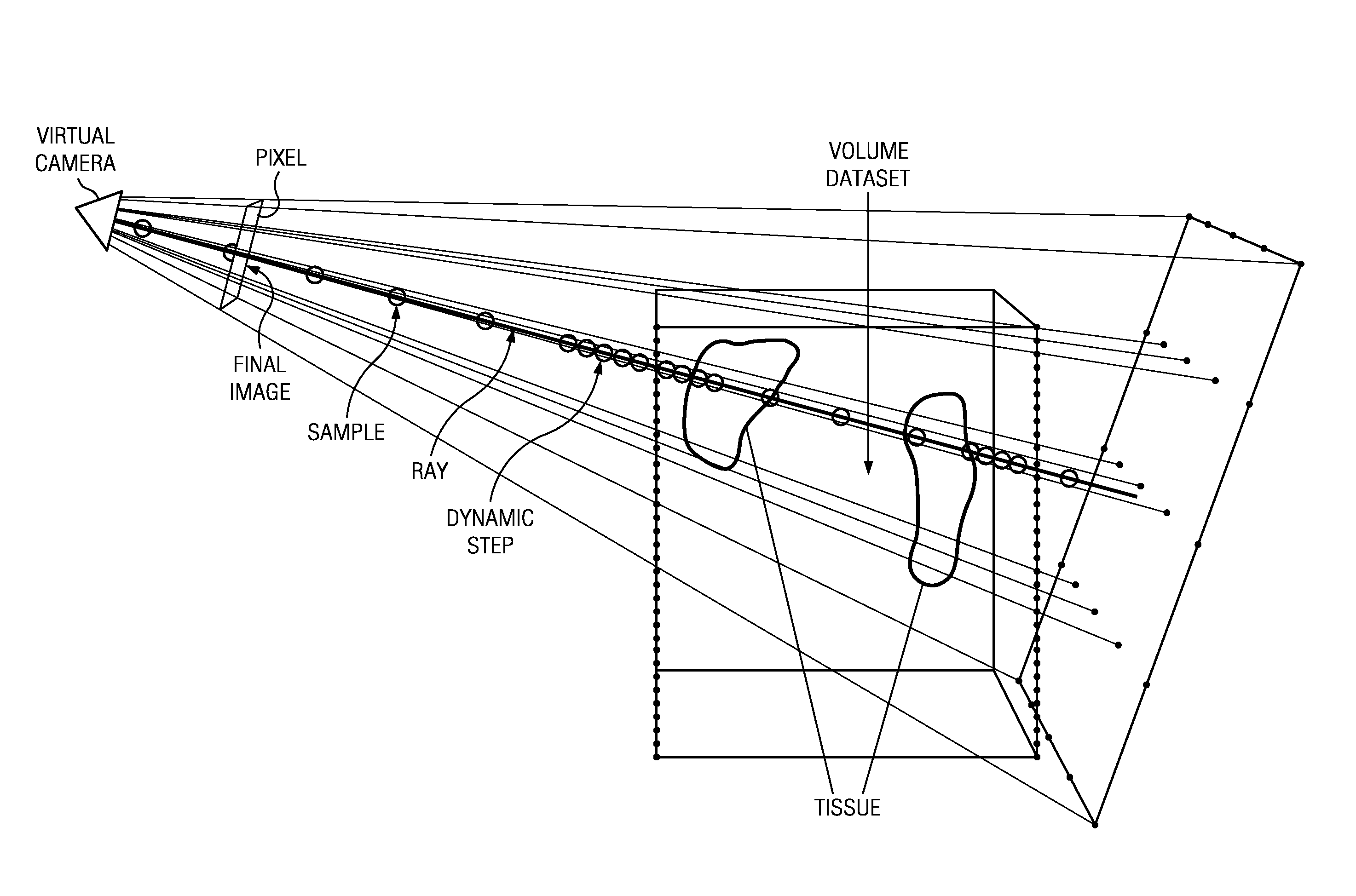 Relative maximum intensity projection