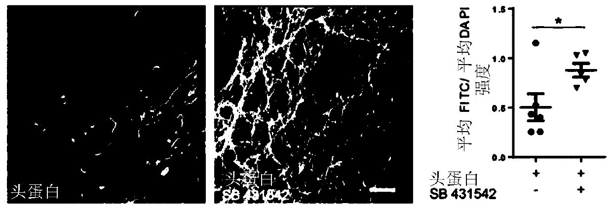 Methods of producing bioengineered neuronal organoids (BENOS) and uses thereof