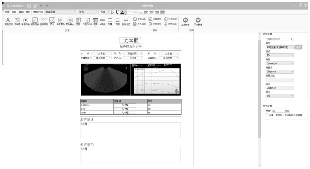 Ultrasonic data processing method, device, computer equipment and storage medium