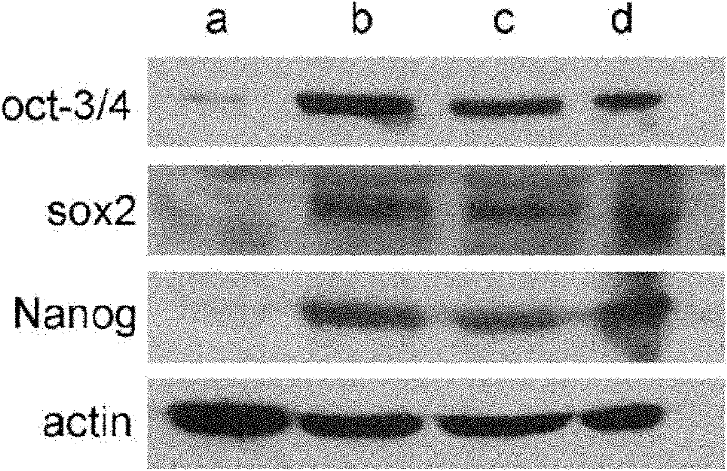 Method for culturing human artificially induced pluripotent stem cells by using human amnion mesenchyme cells as culture layer