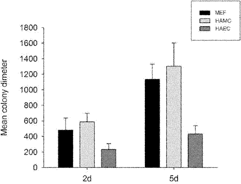 Method for culturing human artificially induced pluripotent stem cells by using human amnion mesenchyme cells as culture layer