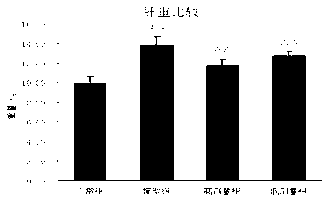 Traditional Chinese medicine composition for treating simple obesity, and preparation method and application thereof