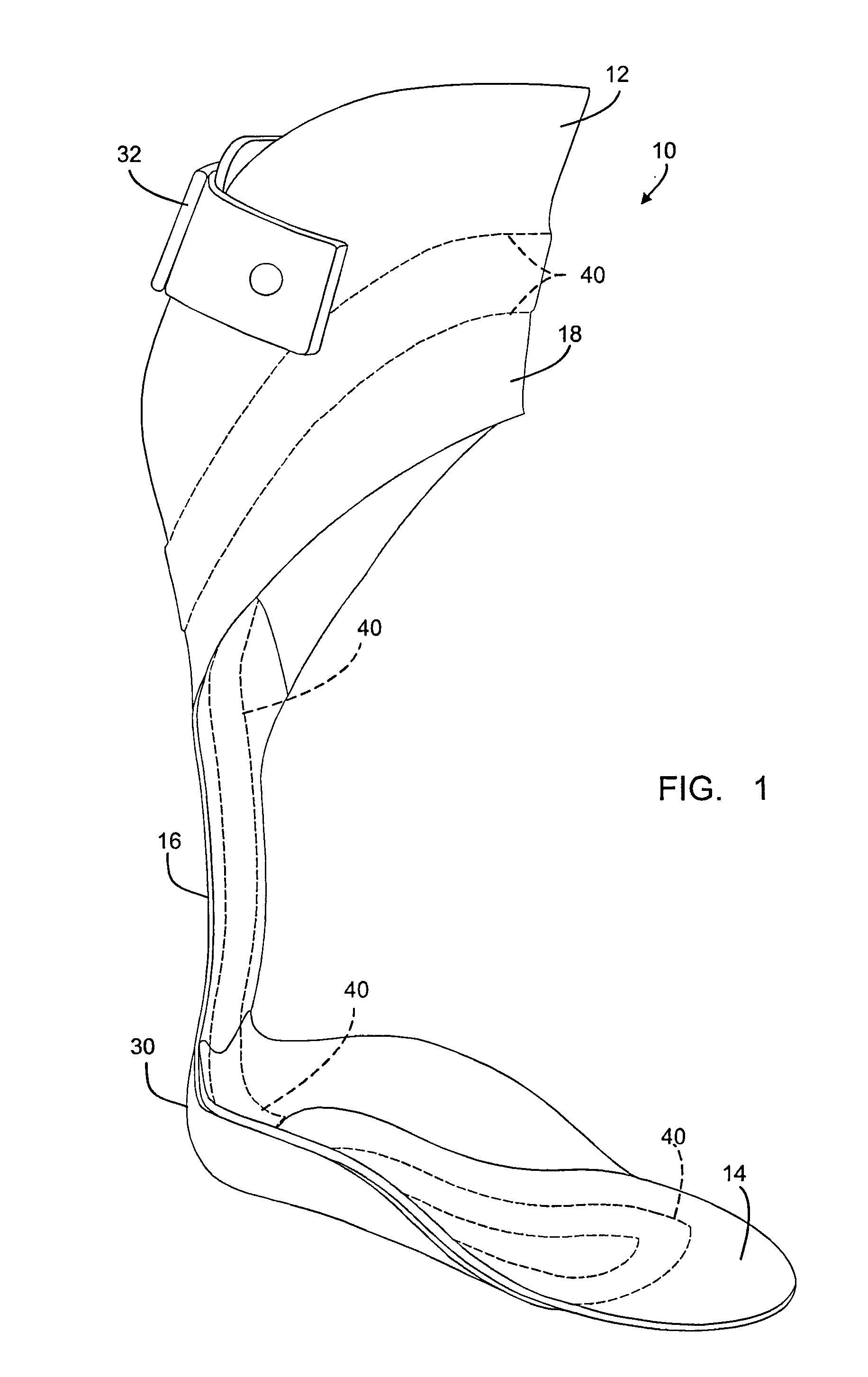 Carbon fiber orthosis and associated method