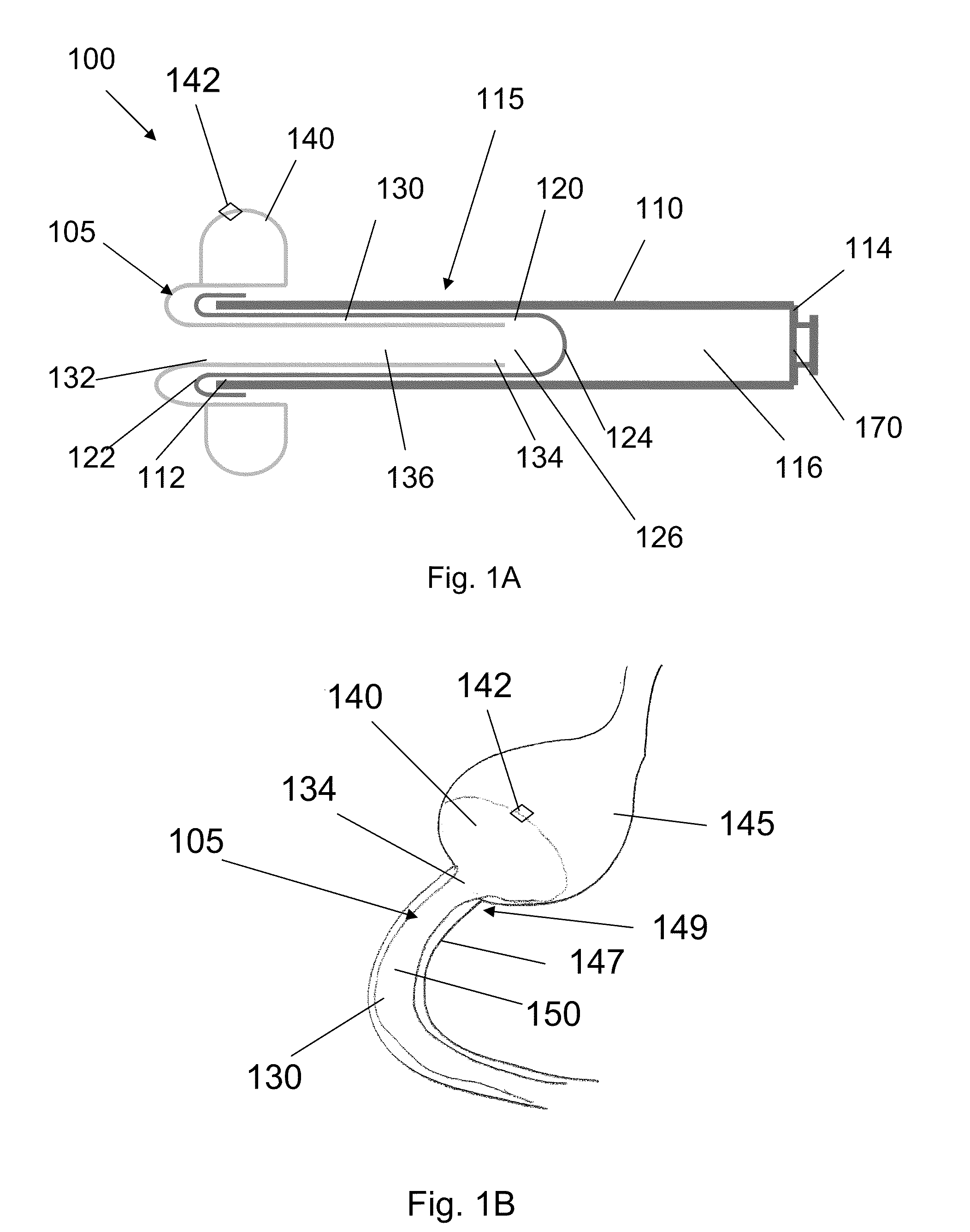 Systems and methods for bariatric therapy