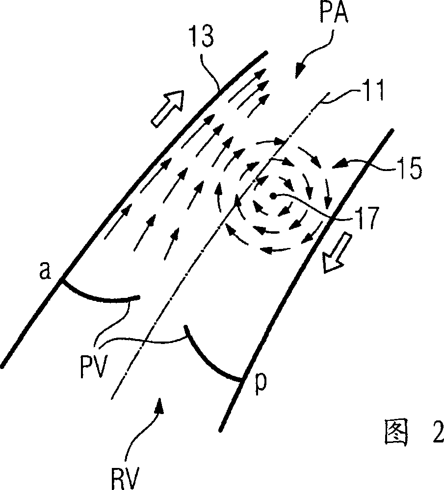 Method and medical imaging apparatus for examination of human or animal body