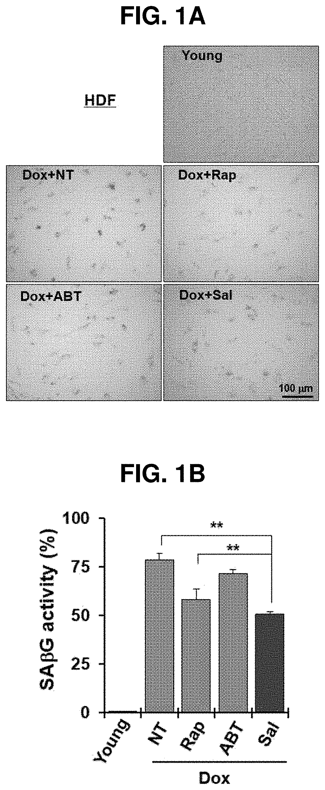 Composition for preventing or treating cellular senescence-related diseases comprising salinomycin as effective component
