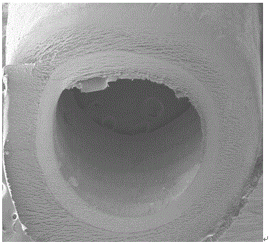 Preparation method of double-layer intravascular stent