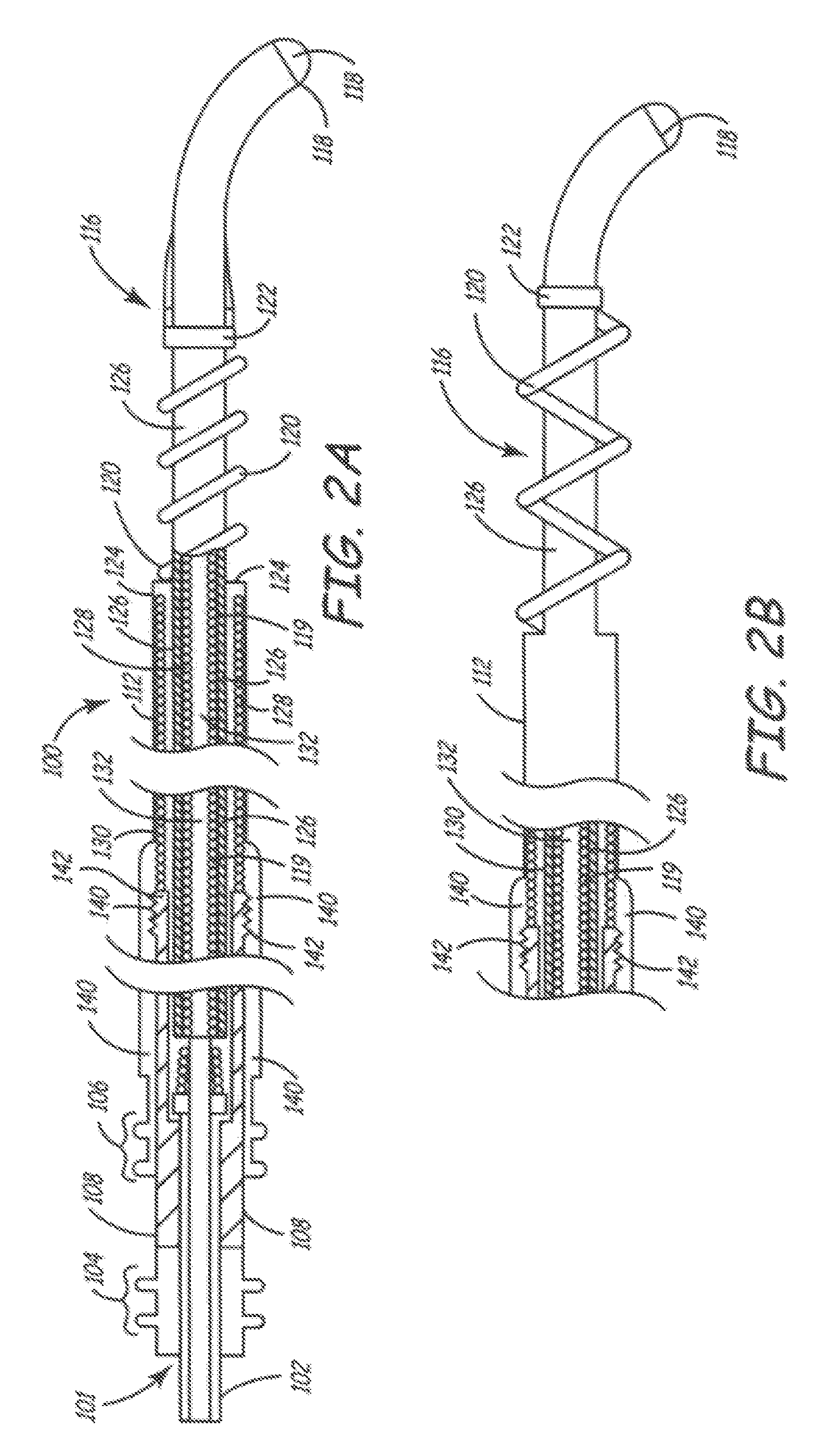 Method of deployable medical lead fixation