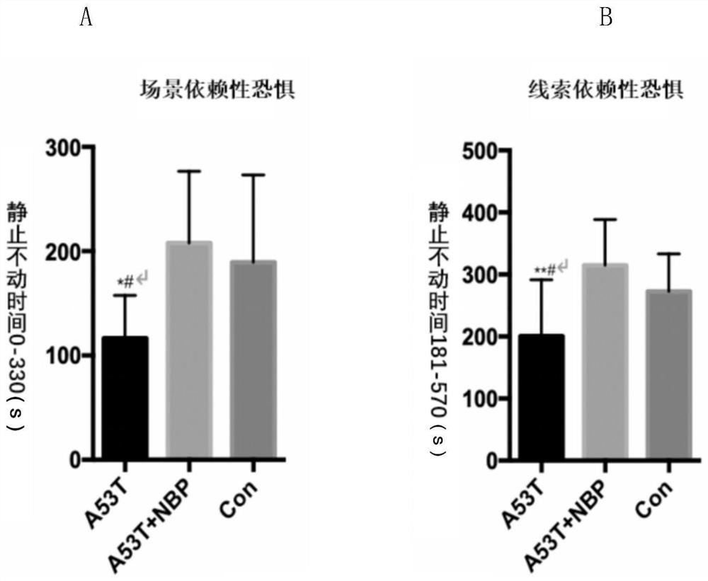 Application of butylphthalide in preparation of medicine for treating dementia with Lewy bodies