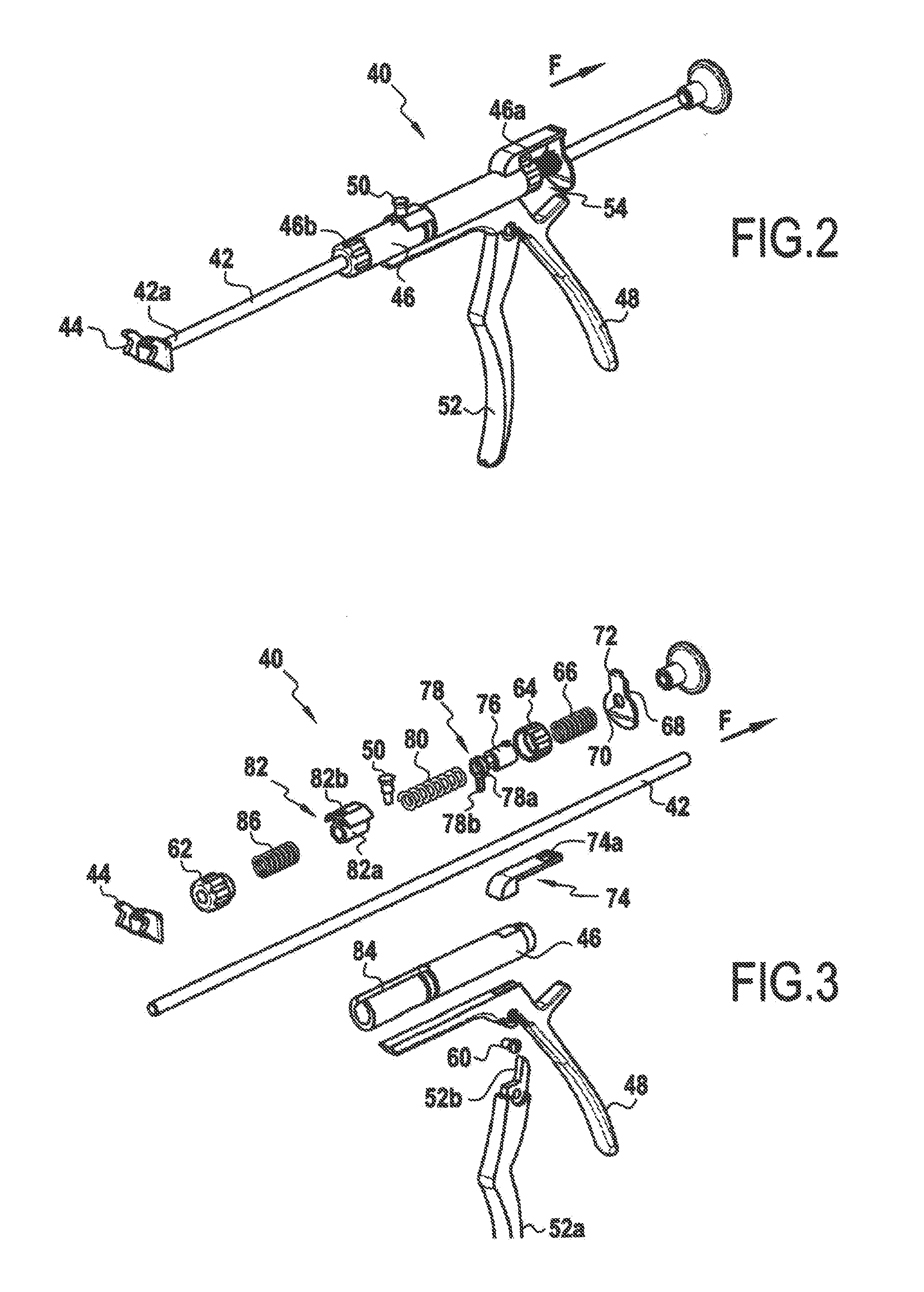 Method and instrument for tensioning a flexible tie