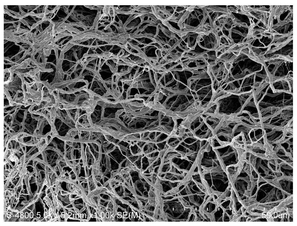 Acellular matrix-cell composite particles for hair growth and preparation method