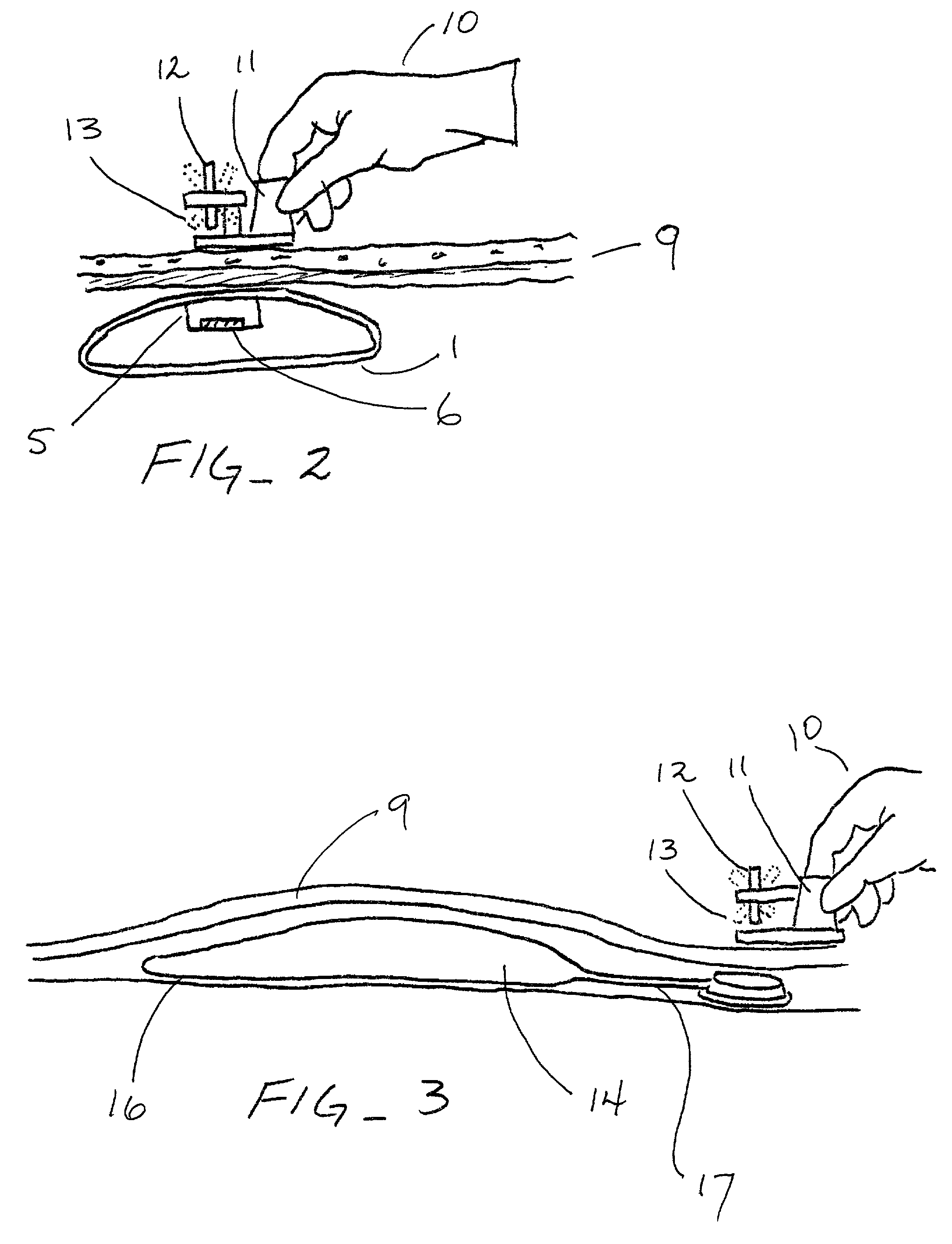 Tissue expander apparatus with magnetically locatable injection site and methods for use