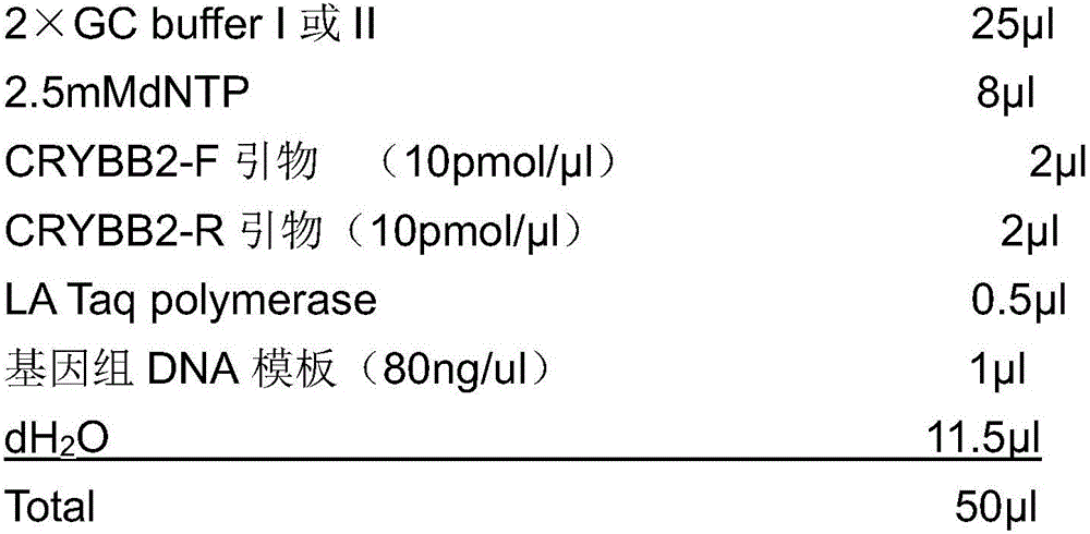 Application of CRYBB2 gene in preparation of product for detecting congenital cataract