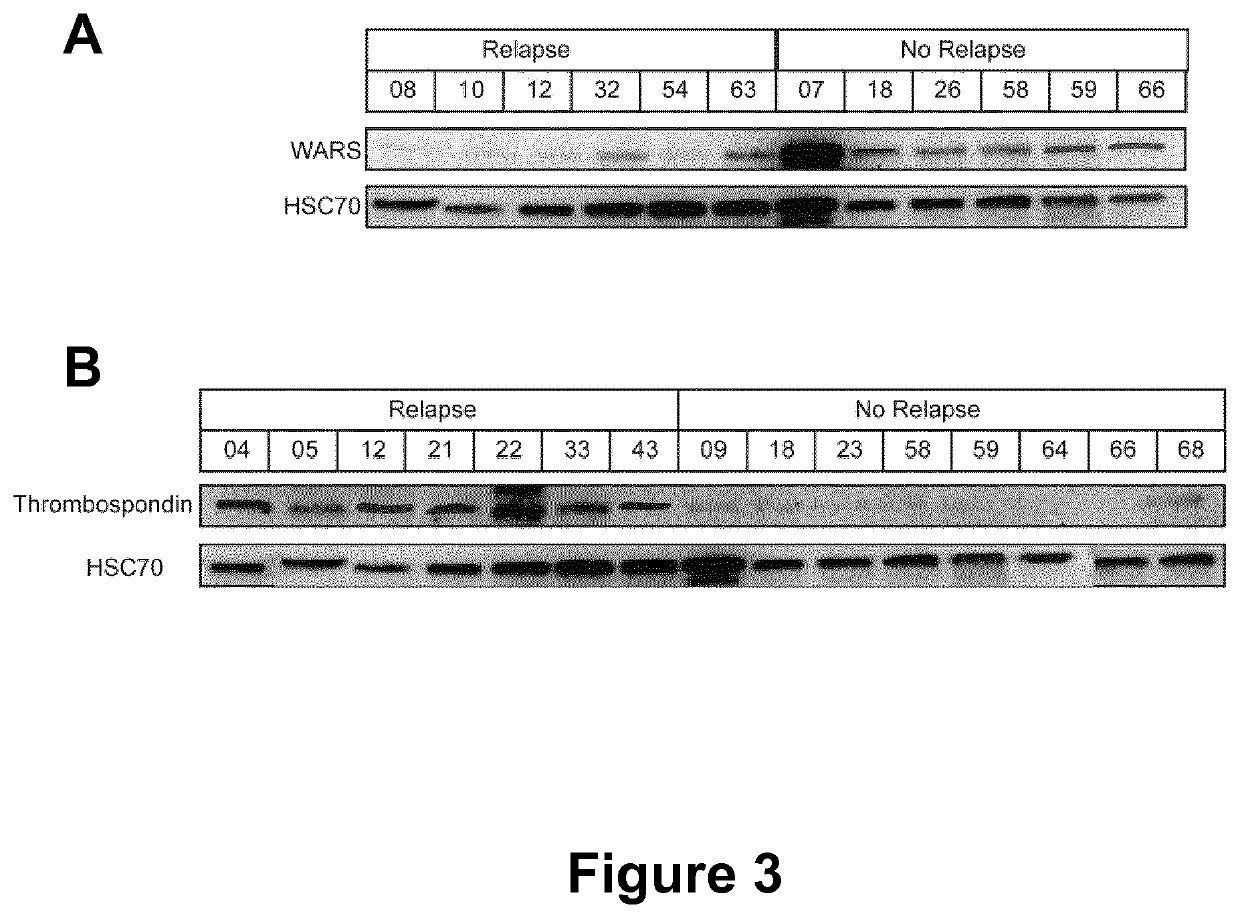 Method for in vitro diagnosing and prognosing of triple negative breast cancer recurrence