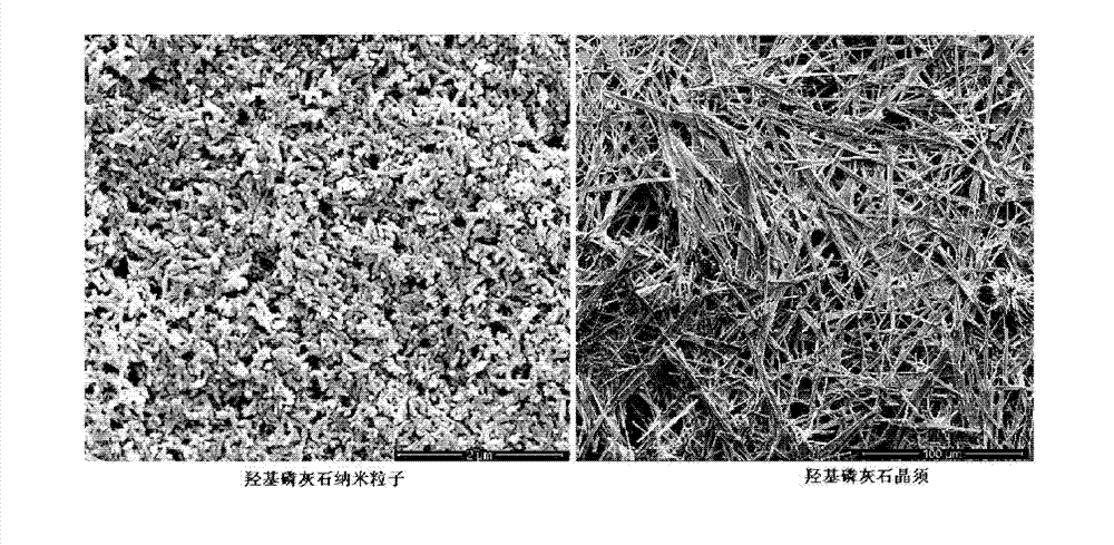 Composite material used for interbody fusion cage and its preparation method