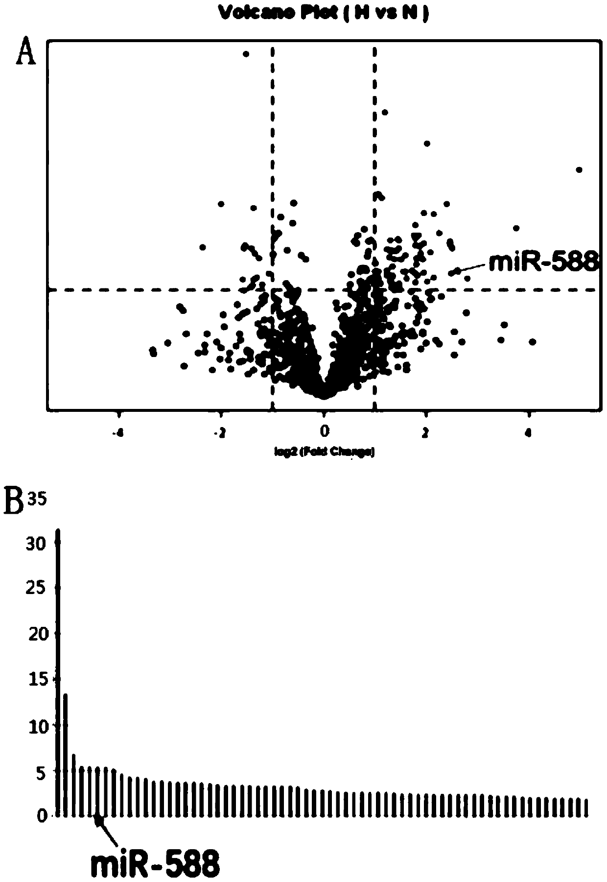 Molecular markers for diagnosing or treating glioma and their application