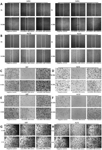 Molecular markers for diagnosing or treating glioma and their application