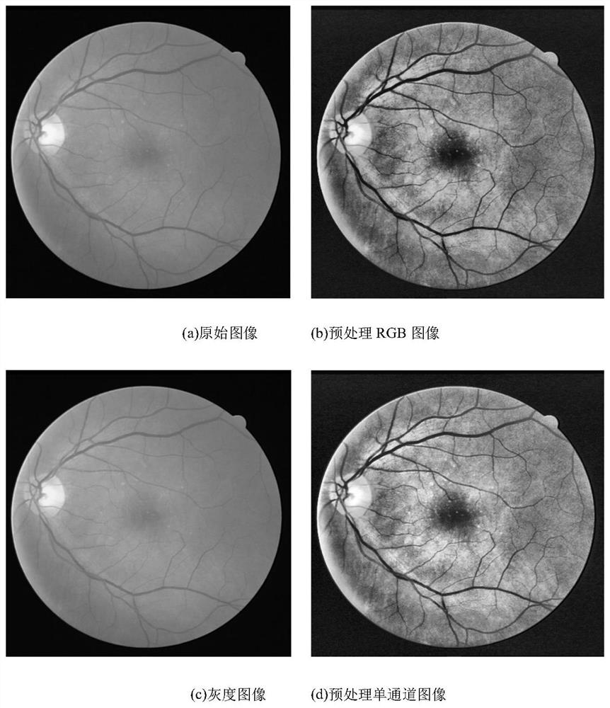Retina image blood vessel segmentation method based on improved U-Net network