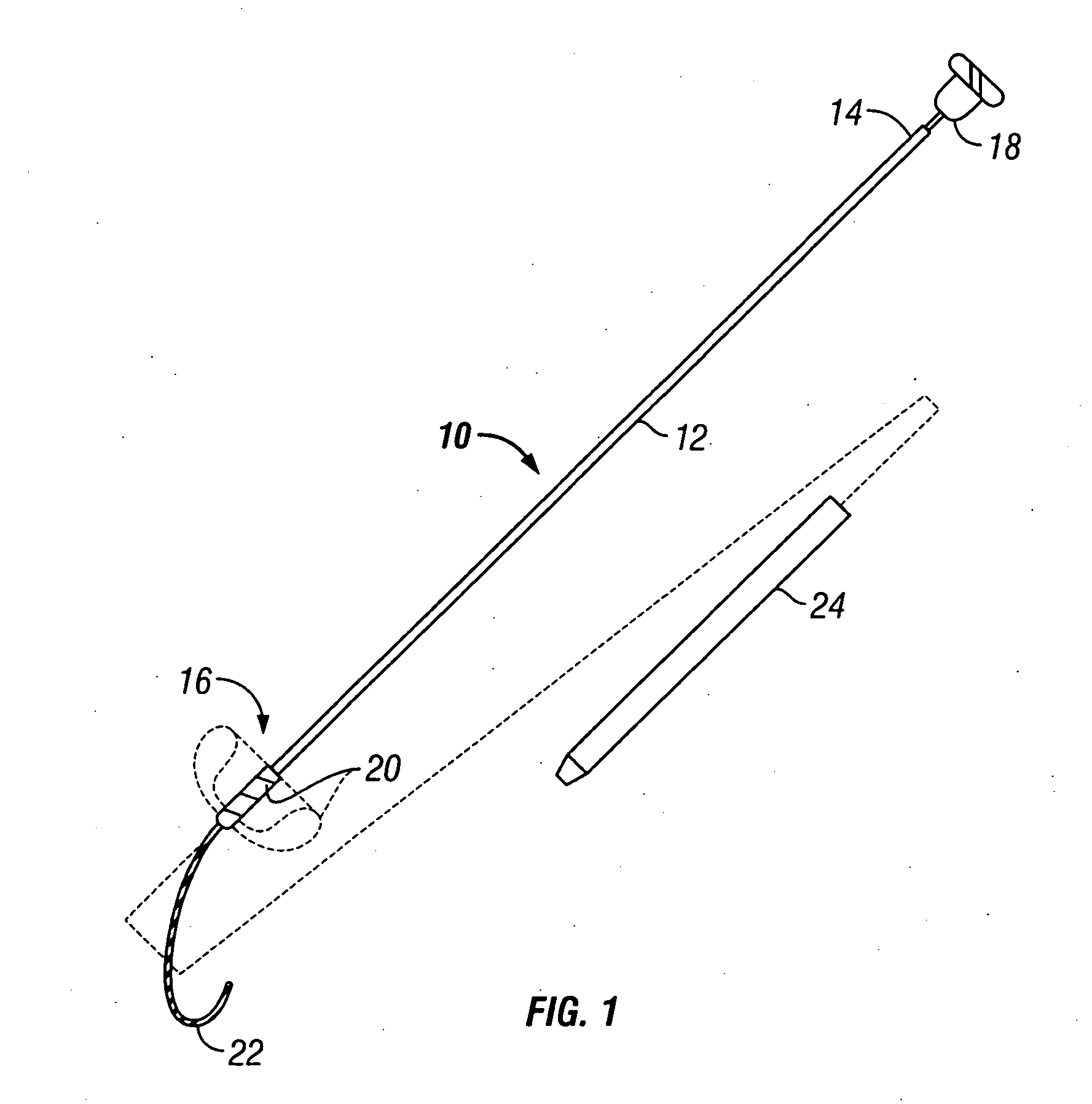 Methods and apparatus for forming anastomotic sites