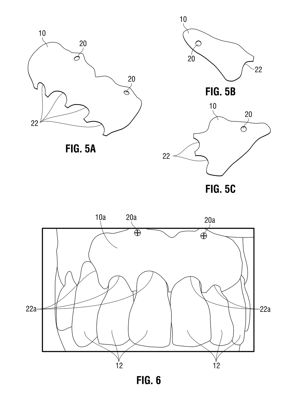 Method and system for making and using an occlusive barrier for bone regeneration and occlusive barrier obtained by said method