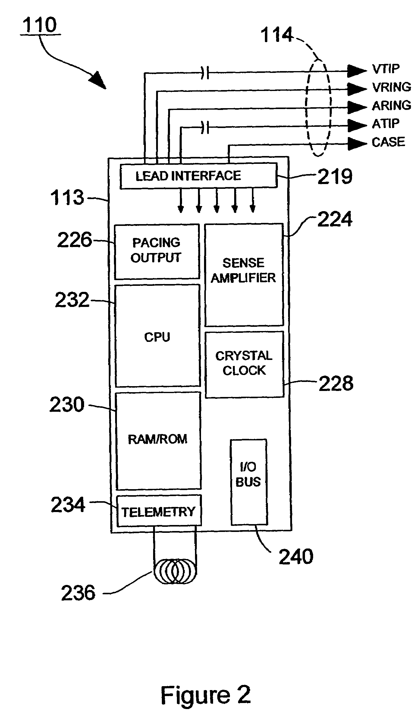 Device for sensing cardiac activity in an implantable medical device in the presence of magnetic resonance imaging interference
