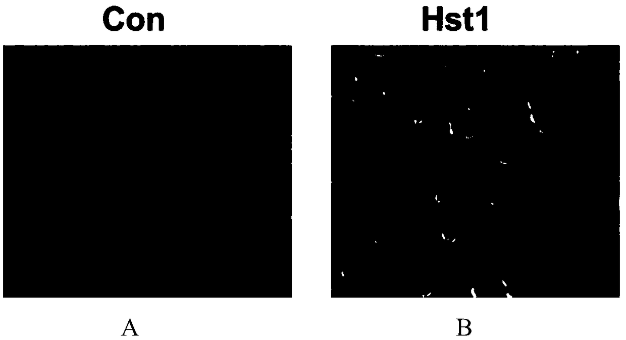 Application of histatin 1 (Hst1) polypeptide in preparation of composite materials for promoting repair of large-area skin defects
