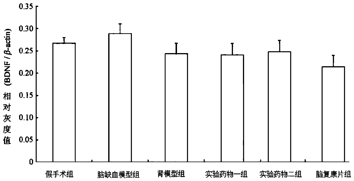 Kidney-tonifying traditional Chinese medicine composition for treating ischemic brain injury and preparation method thereof