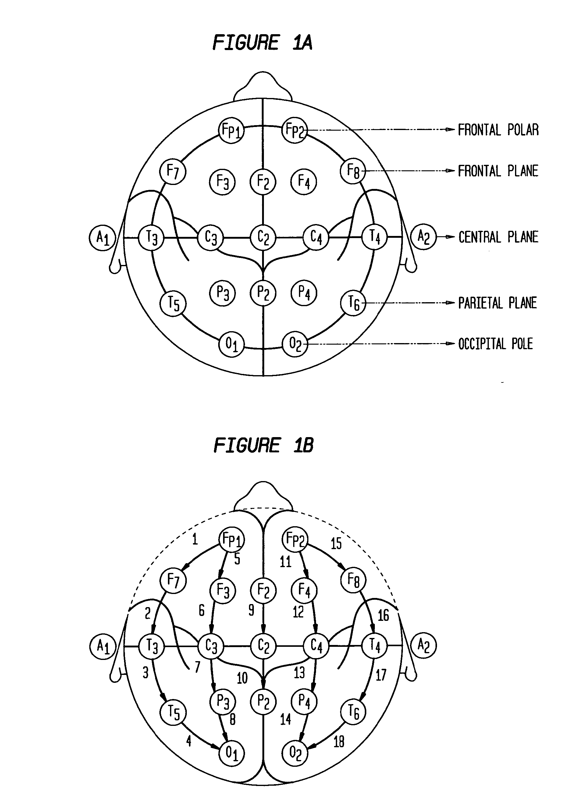 Patient-Specific Seizure Onset Detection System