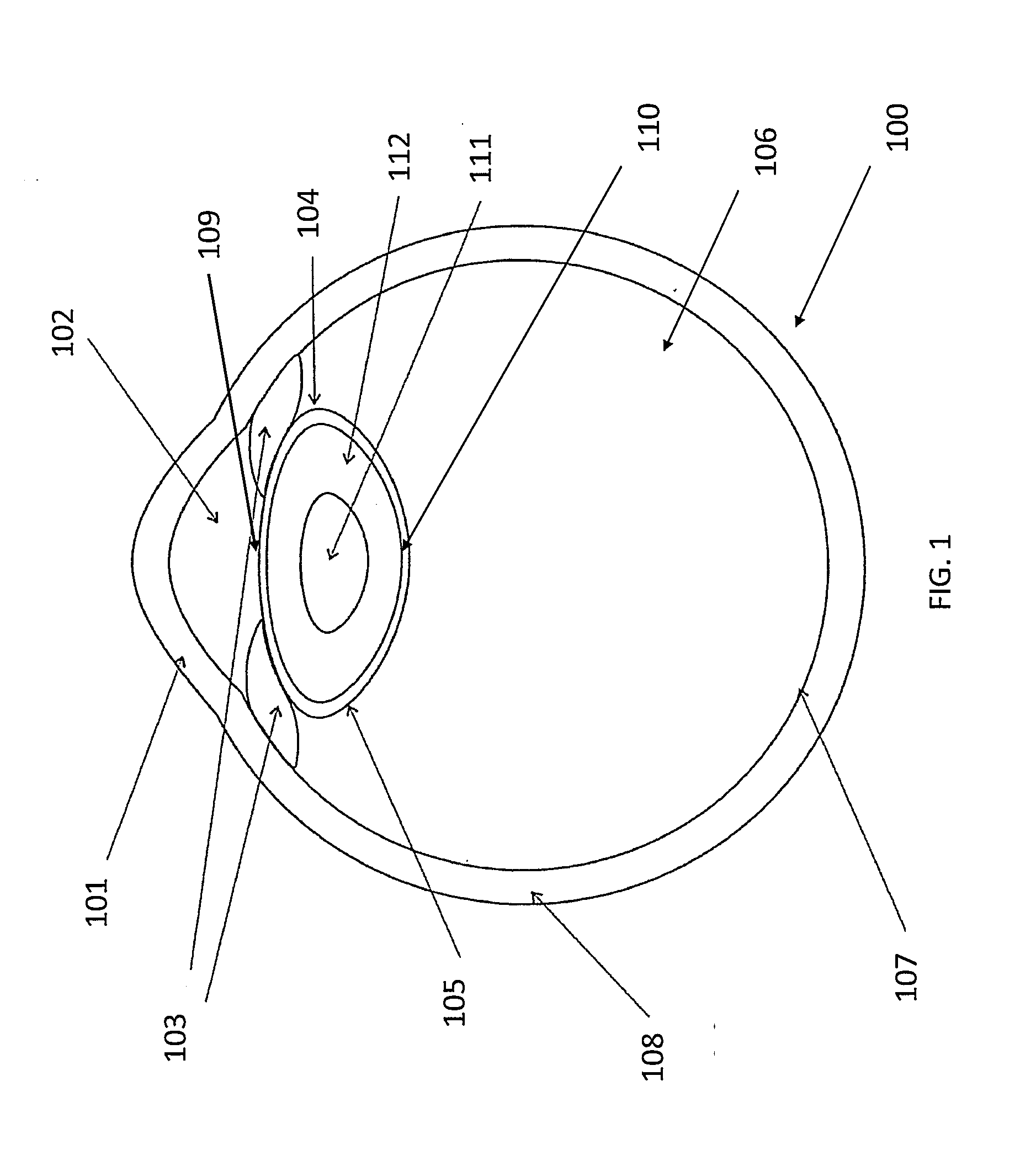 Method and apparatus for laser assisted cataract surgery