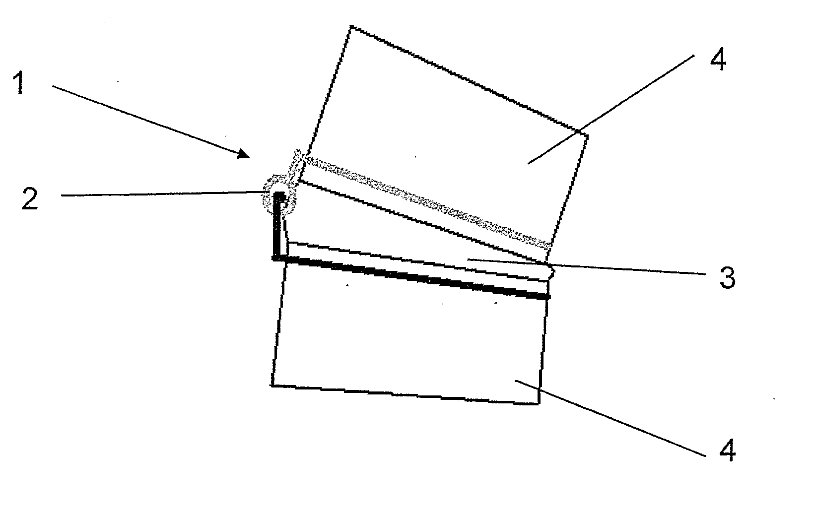 Implantable apparatus for modulation of skeletal growth