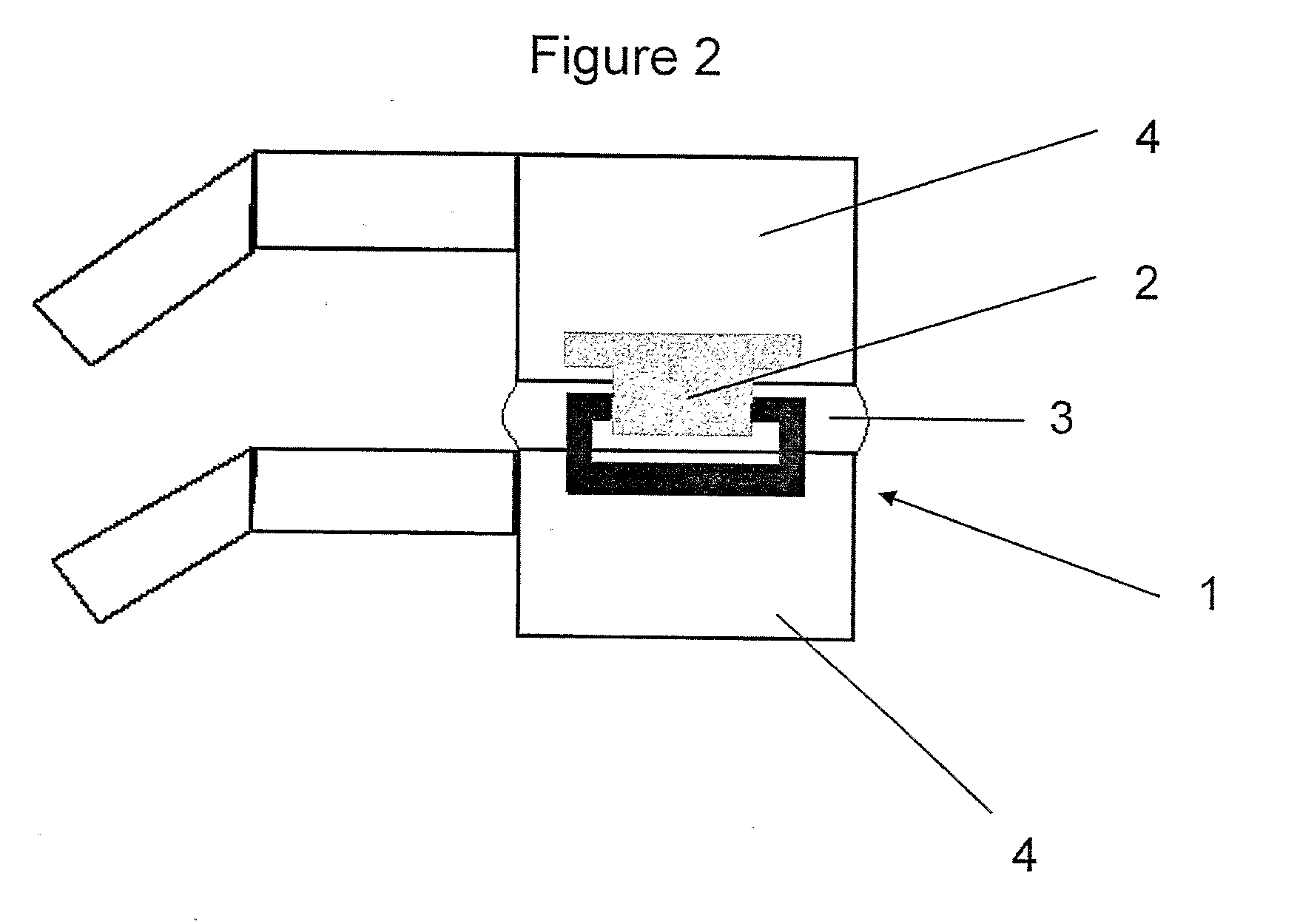 Implantable apparatus for modulation of skeletal growth