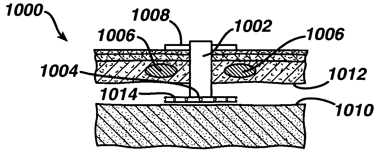 Localized pleurodesis evacuation device