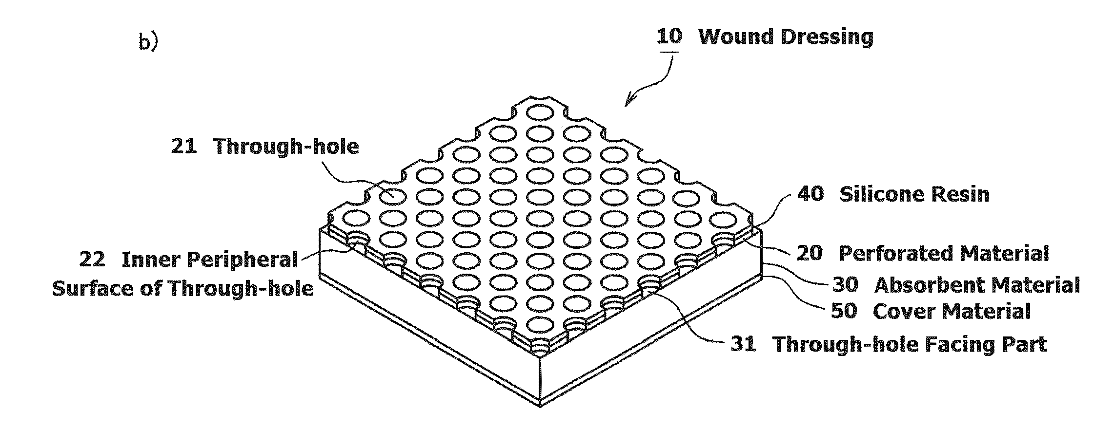 Wound dressing and method for producing it