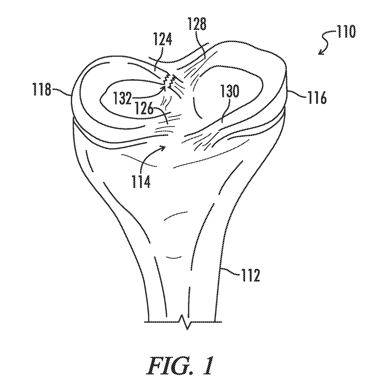 Self-cinching suture construct apparatus