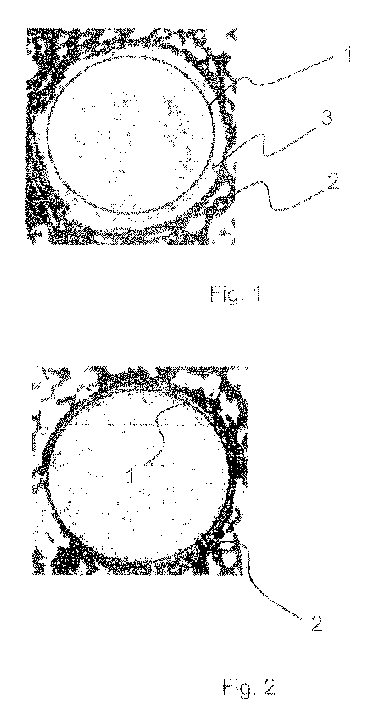 Bone cement and a method for producing same