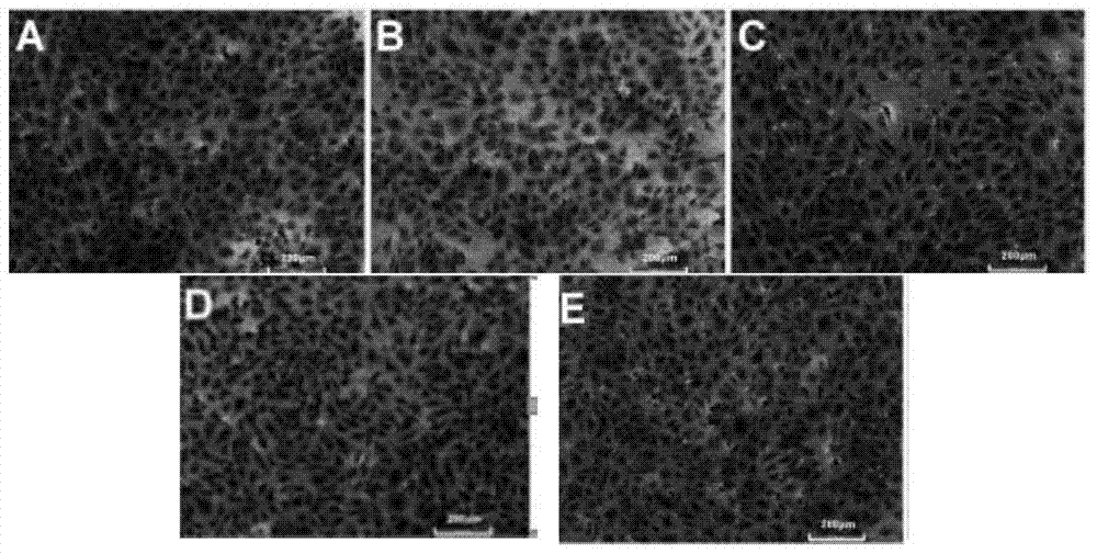 Application of angiopoietin-like protein 4 in protecting barrier function of endothelia