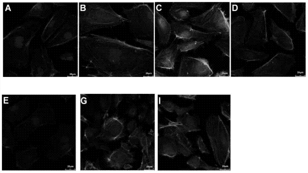 Application of angiopoietin-like protein 4 in protecting barrier function of endothelia