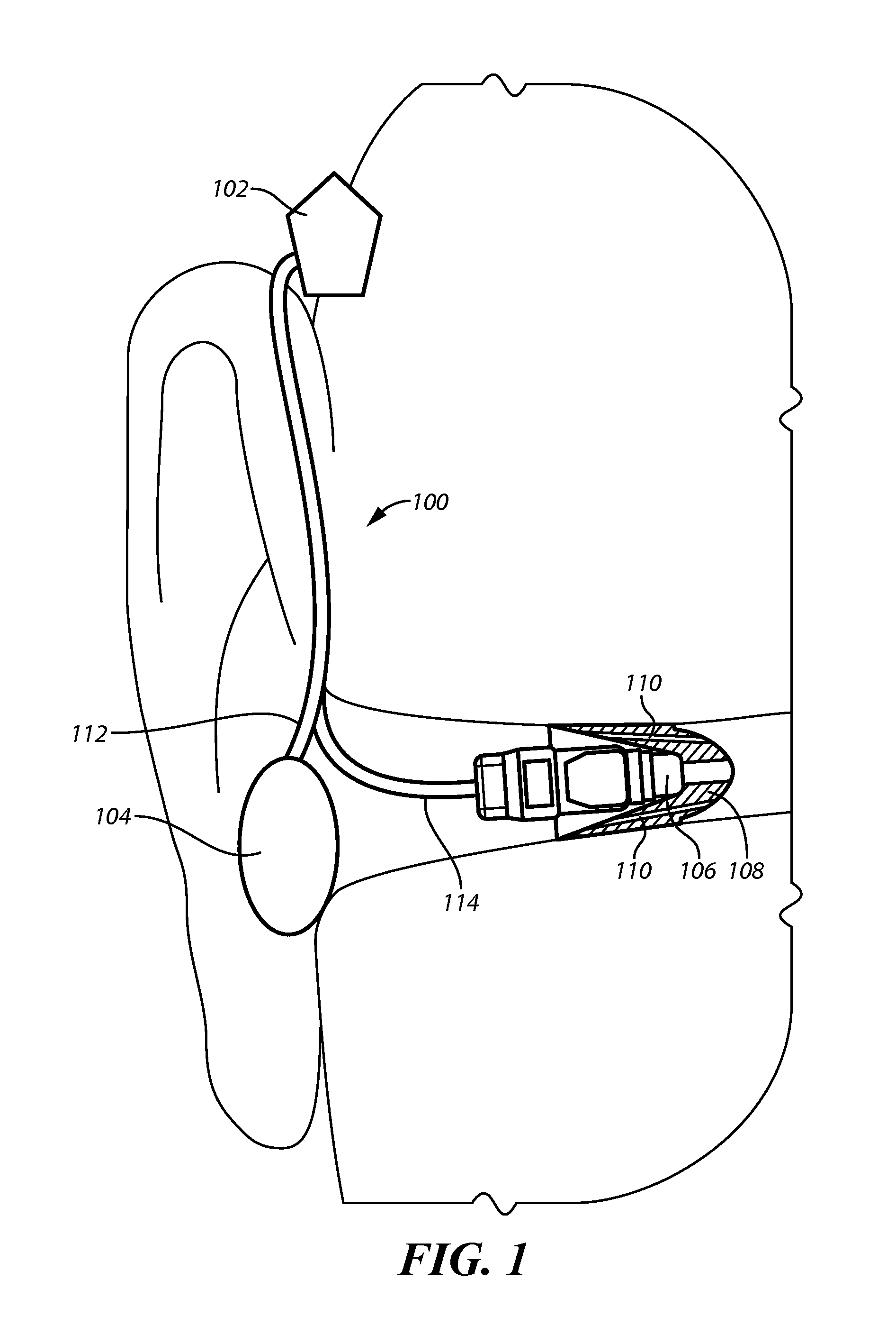 Dynamic Driver In Hearing Instrument