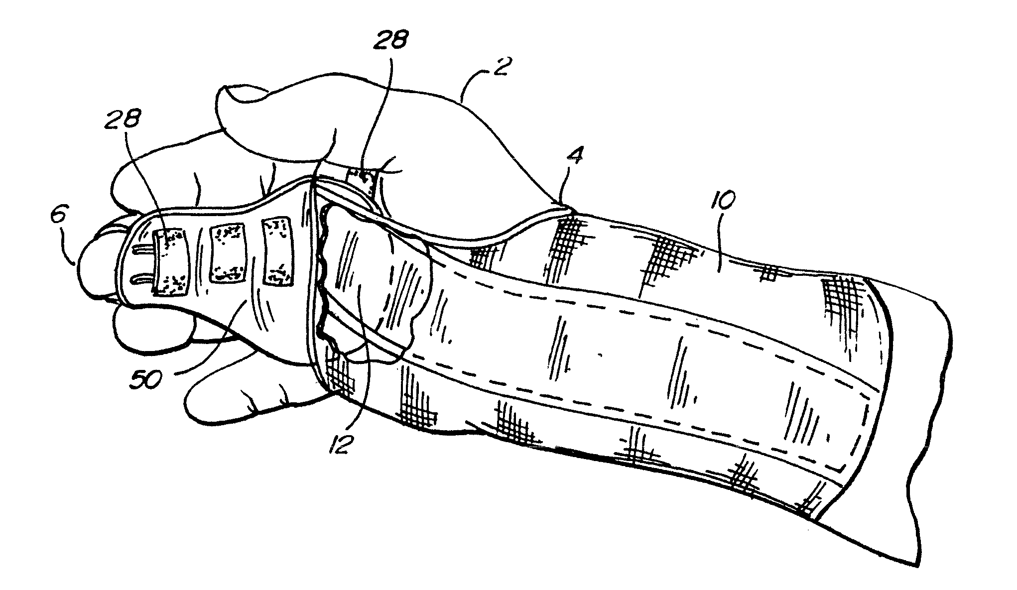 Spherical section hand splint