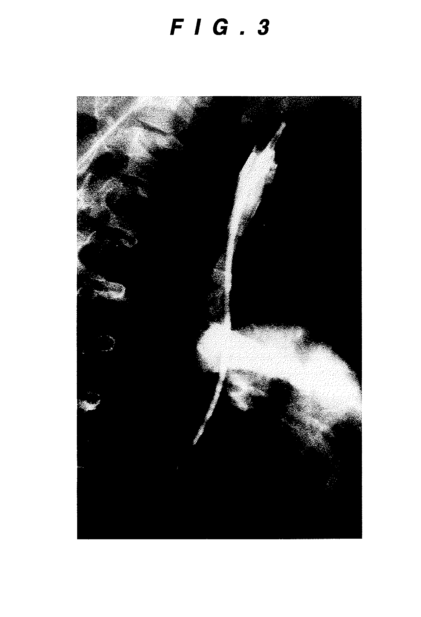 Matrix for regenerating cardiovascular tissue and method for regenerating cardiovascular tissue