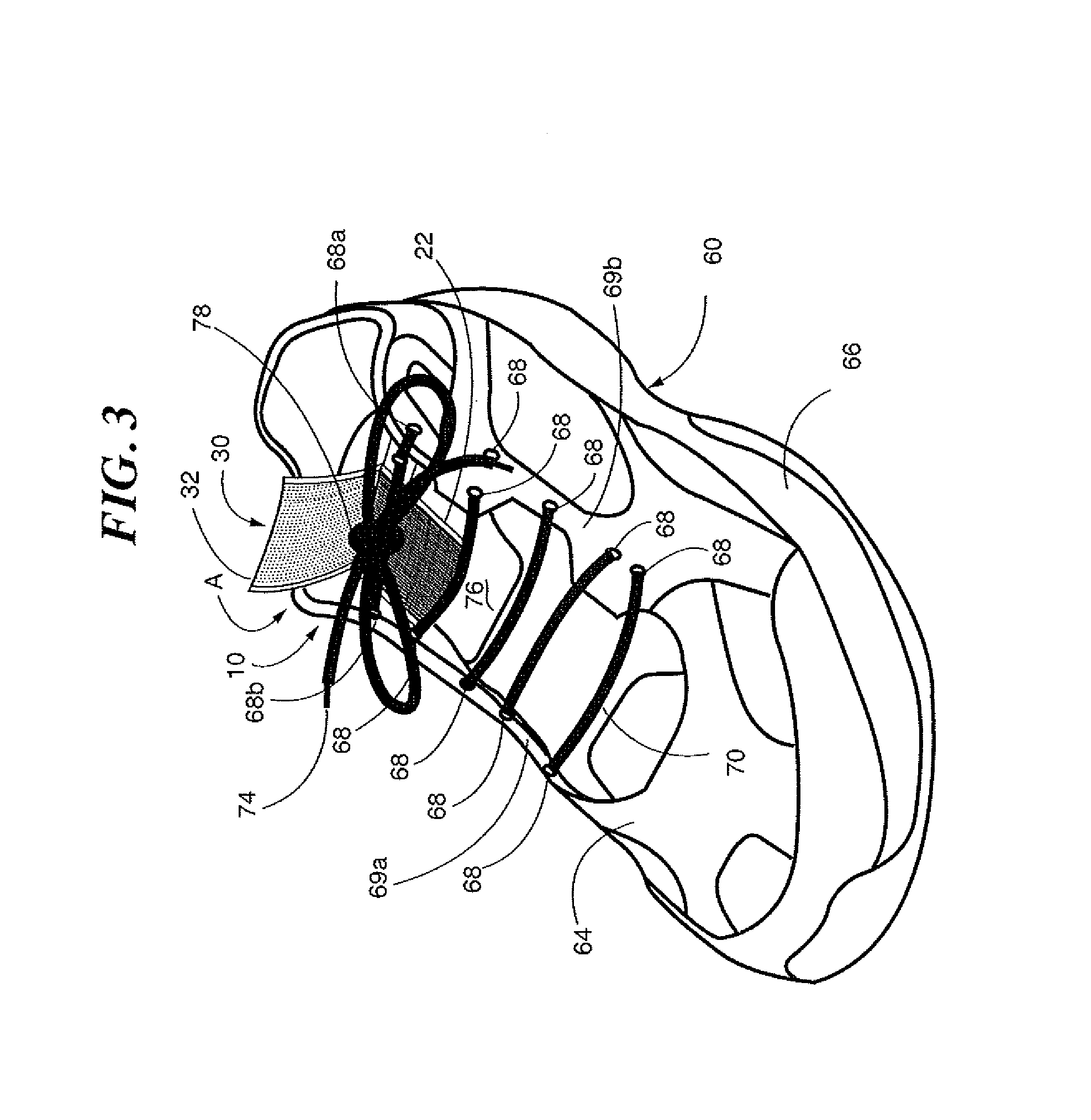 Device for maintaining a tied shoe lace knot