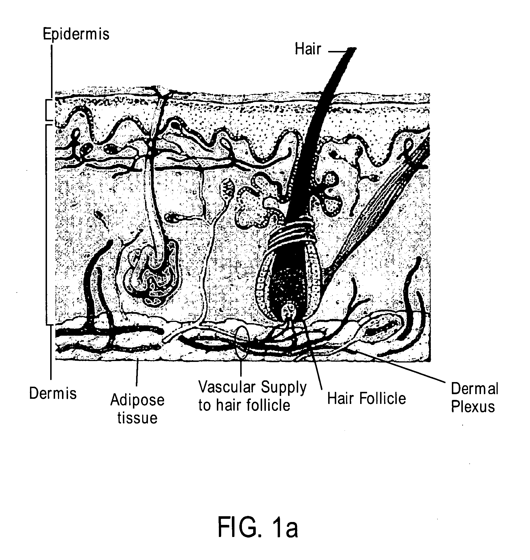 Apparatus and method for treating biological external tissue